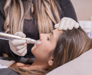 ha-microneedling-small-img