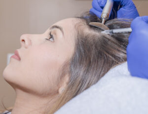 hair-treatment-small