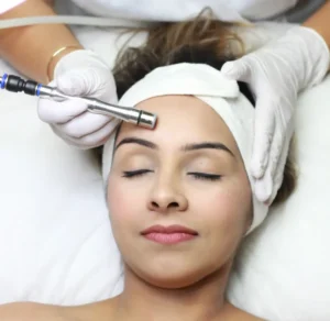 microdermabrasion-tab