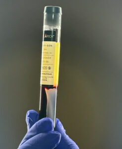 shoulder-pain-plasma