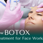 How botox Treatment for Face Works