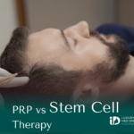 PRP vs Stem Cell Therapy