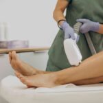 laser hair removal in Mississauga