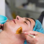 chemical peels in Mississauga