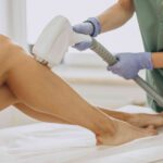 Laser hair removal in Oakville