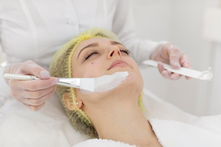 chemical peels in Erin Mills