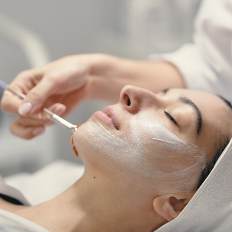Chemical Peels in Clarkson