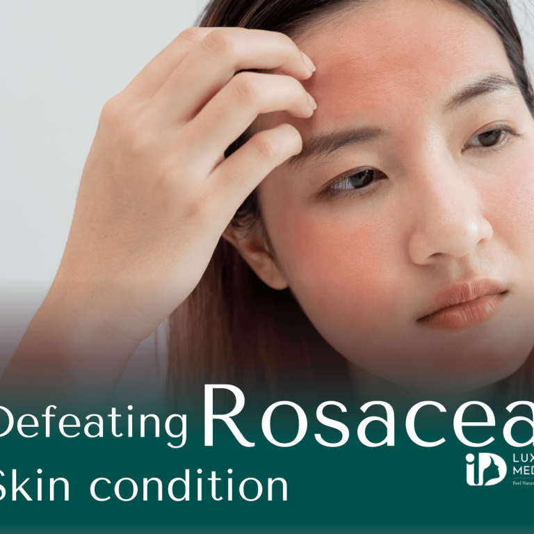 Defeating Rosacea Skin condition