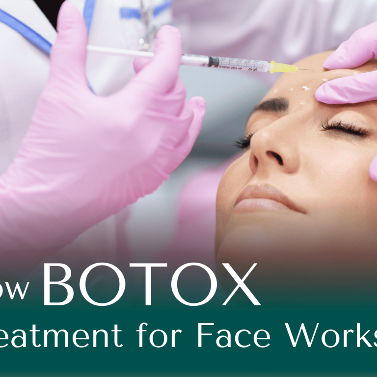 How botox Treatment for Face Works