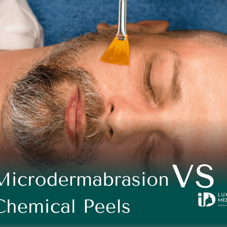 Microdermabrasion vs Chemical Peels
