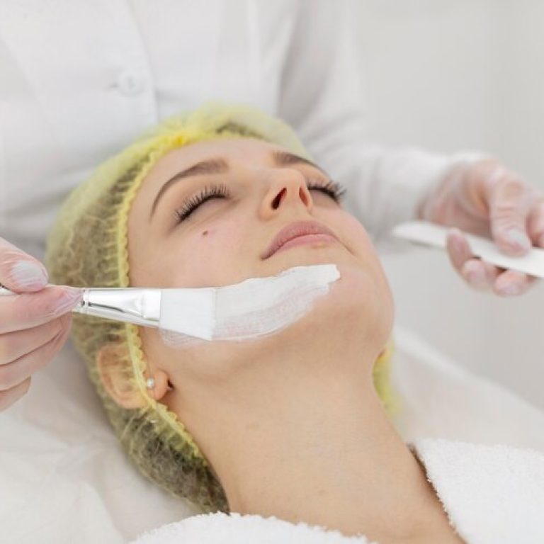 chemical peels in Erin Mills